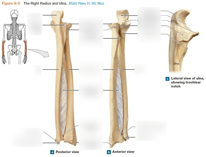 Radius and ulna bone quiz