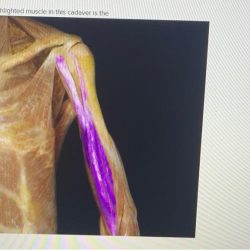 What is the function of the highlighted muscle