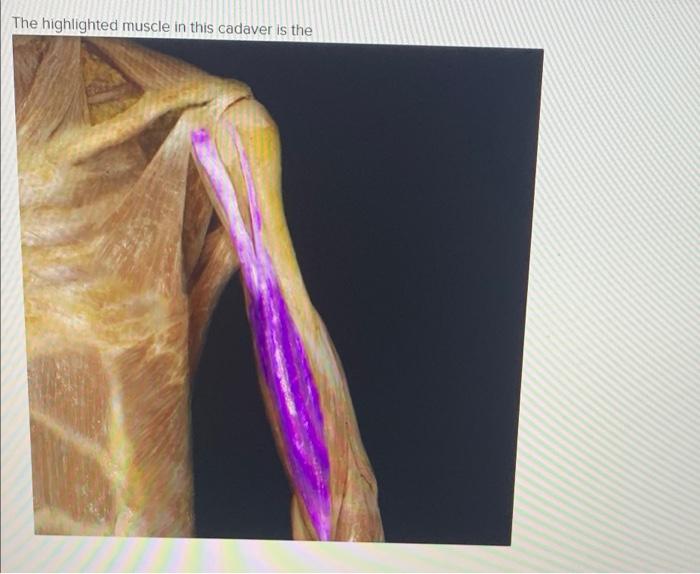 What is the function of the highlighted muscle