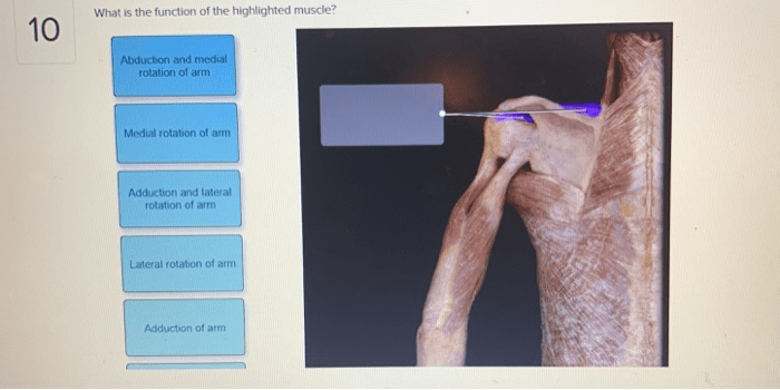 What is the function of the highlighted muscle