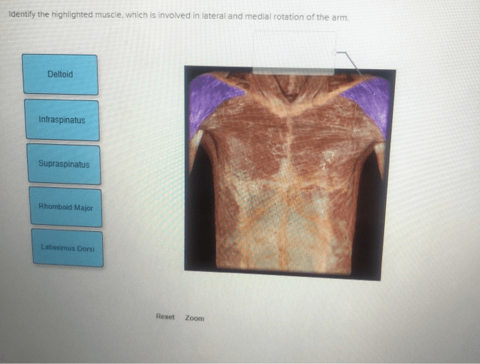 Muscle highlighted lt solved which